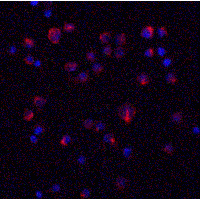 IL11 Antibody - Immunofluorescence of IL-11 in HeLa cells with IL-11 antibody at 20 µg/ml.