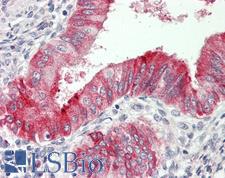 IL12A / p35 Antibody - Human Uterus: Formalin-Fixed, Paraffin-Embedded (FFPE)