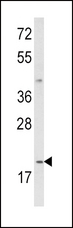 IL12A / p35 Antibody - Western blot of IL12A Antibody in MDA-MB231 cell line lysates (35 ug/lane). IL12A (arrow) was detected using the purified antibody.