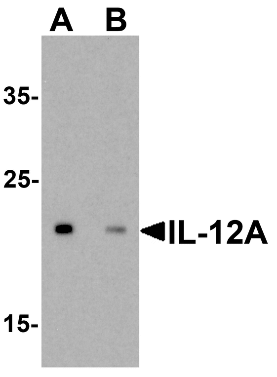 IL12A / p35 Antibody - Western blot analysis of IL-12A in HeLa cell lysate with IL-12A antibody at 0.5 ug/ml in (A) the absence and (B) the presence of blocking peptide.