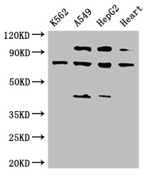 IL12RB1 / CD212 Antibody - Positive WB detected in:K562 whole cell lysate,A549 whole cell lysate,HepG2 whole cell lysate,Rat heart tissue;All lanes:IL12RB1 antibody at 3.5?g/ml;Secondary;Goat polyclonal to rabbit IgG at 1/50000 dilution;Predicted band size: 74,73,43 KDa;Observed band size: 74,43,110 KDa;