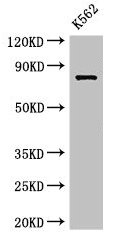 IL12RB1 / CD212 Antibody - Western Blot Positive WB detected in: K562 whole cell lysate All lanes: IL12RB1 antibody at 3.5µg/ml Secondary Goat polyclonal to rabbit IgG at 1/50000 dilution Predicted band size: 74, 73, 43 kDa Observed band size: 74 kDa