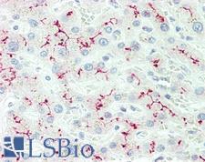 IL12RB2 Antibody - Anti-IL12RB2 antibody IHC staining of human liver. Immunohistochemistry of formalin-fixed, paraffin-embedded tissue after heat-induced antigen retrieval. Antibody dilution 1:50.