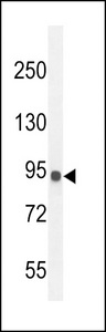IL12RB2 Antibody - IL12RB2 Antibody western blot of MDA-MB435 cell line lysates (35 ug/lane). The IL12RB2 antibody detected the IL12 protein (arrow).