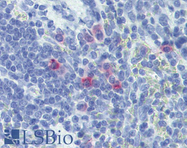 IL13 Antibody - Anti-IL-13 antibody IHC of rat spleen. Immunohistochemistry of formalin-fixed, paraffin-embedded tissue after heat-induced antigen retrieval. Antibody concentration 10 ug/ml.