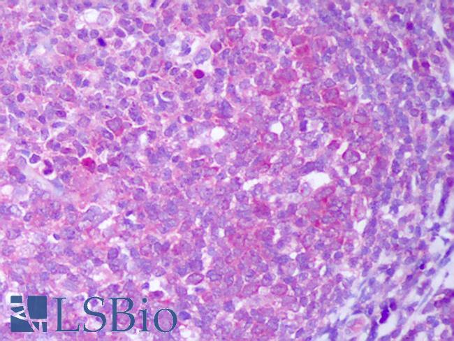 IL13 Antibody - Anti-IL-13 antibody IHC of human tonsil, germinal center. Immunohistochemistry of formalin-fixed, paraffin-embedded tissue after heat-induced antigen retrieval. Antibody concentration 5 ug/ml.