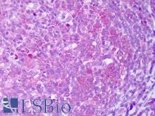 IL13 Antibody - Anti-IL-13 antibody IHC of human tonsil, germinal center. Immunohistochemistry of formalin-fixed, paraffin-embedded tissue after heat-induced antigen retrieval. Antibody concentration 5 ug/ml.