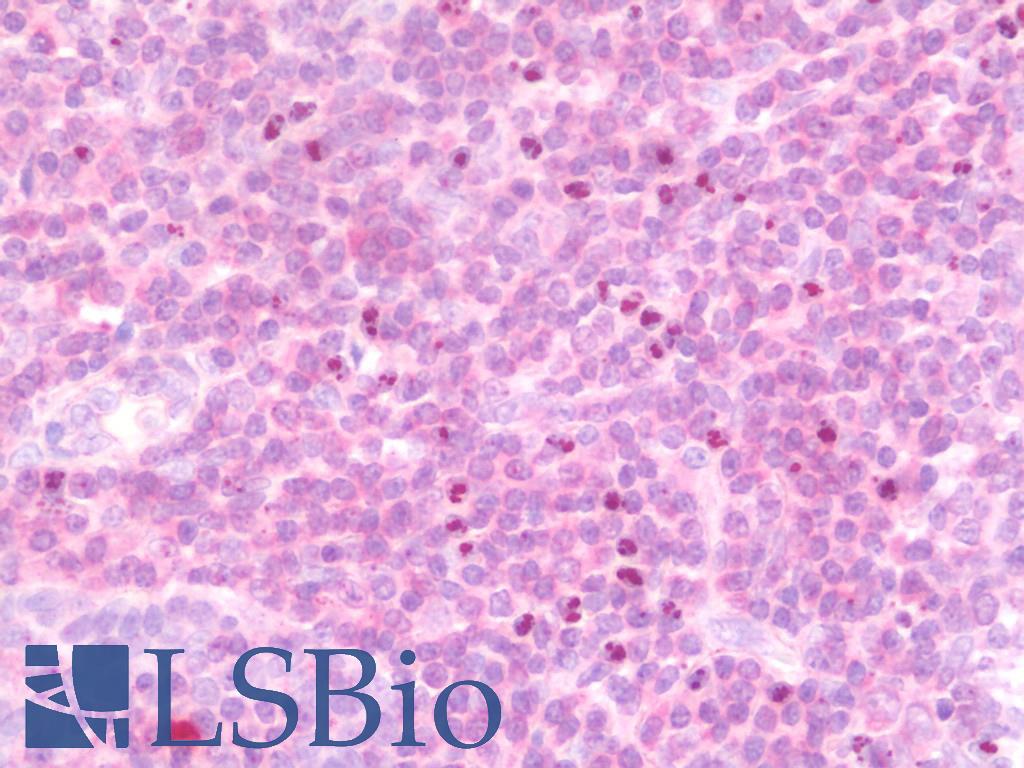 IL15 Antibody - Anti-IL15 antibody IHC staining of human tonsil. Immunohistochemistry of formalin-fixed, paraffin-embedded tissue after heat-induced antigen retrieval. Antibody concentration 10 ug/ml.