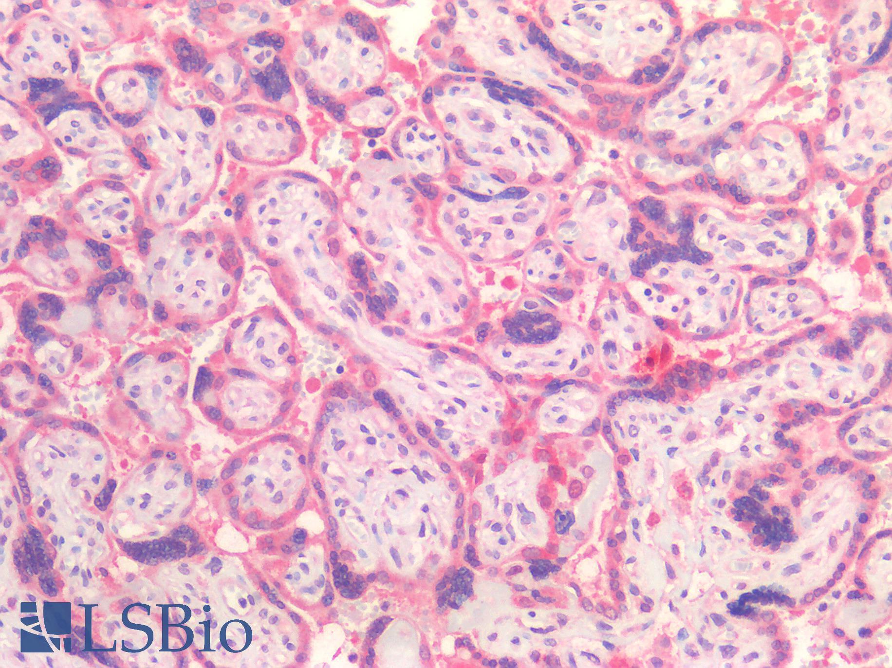 IL15RA Antibody - Human Placenta: Formalin-Fixed, Paraffin-Embedded (FFPE)