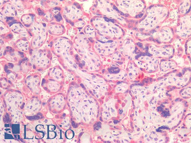 IL15RA Antibody - Human Placenta: Formalin-Fixed, Paraffin-Embedded (FFPE)