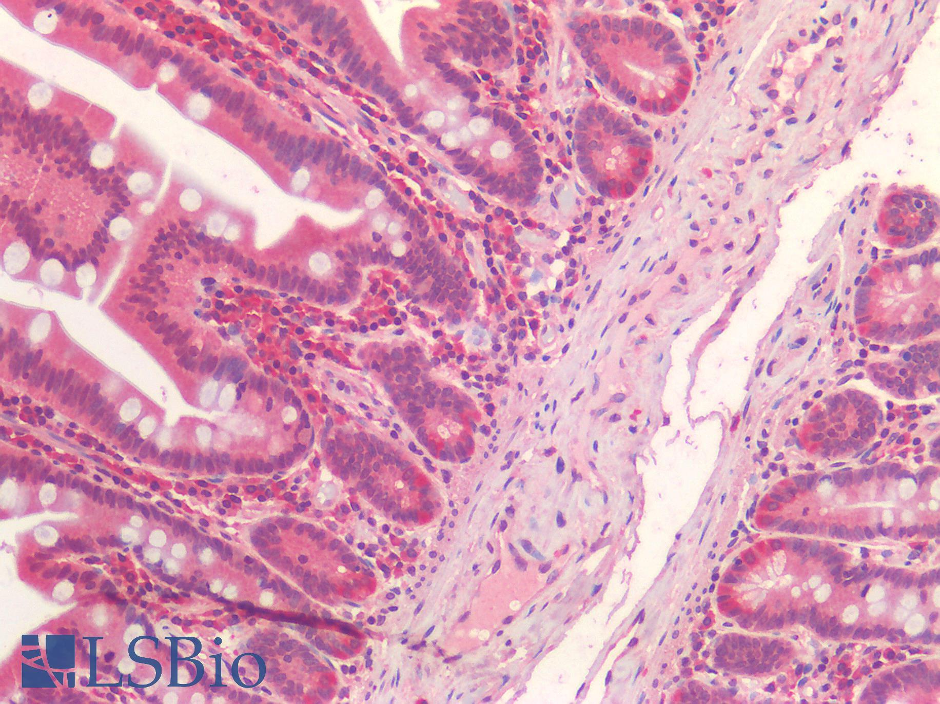 IL15RA Antibody - Human Small Intestine: Formalin-Fixed, Paraffin-Embedded (FFPE)
