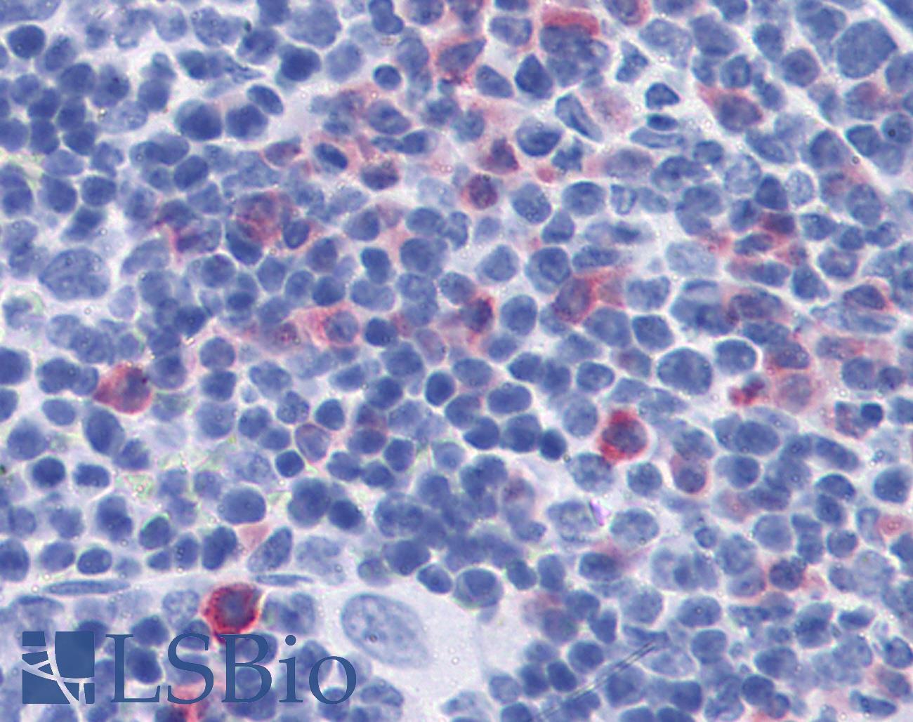 IL17 Antibody - Anti-IL-17 antibody IHC of mouse spleen. Immunohistochemistry of formalin-fixed, paraffin-embedded tissue after heat-induced antigen retrieval. Antibody concentration 10 ug/ml.