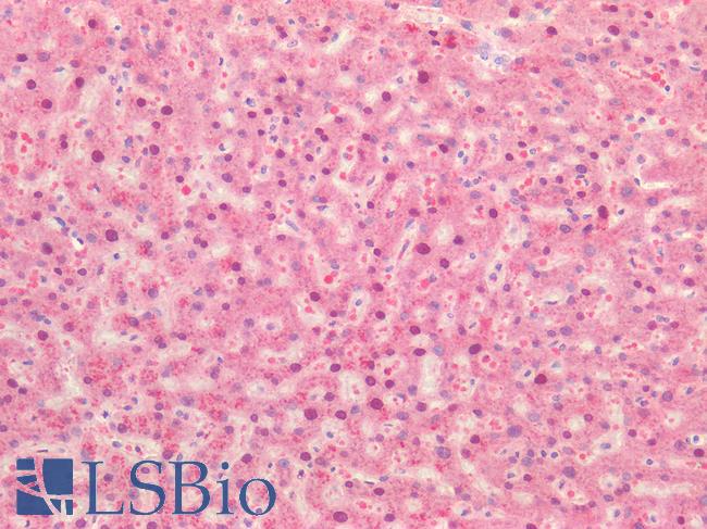 IL17A Antibody - Human Liver: Formalin-Fixed, Paraffin-Embedded (FFPE)