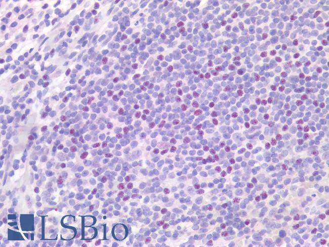 IL17A Antibody - Human Tonsil: Formalin-Fixed, Paraffin-Embedded (FFPE)