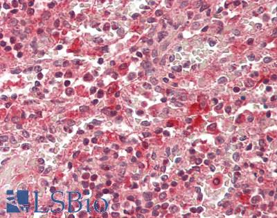 IL17A Antibody - Human Spleen: Formalin-Fixed, Paraffin-Embedded (FFPE)