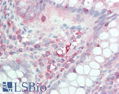 IL17D Antibody - Human Colon: Formalin-Fixed, Paraffin-Embedded (FFPE)