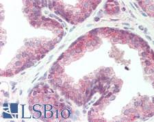 IL17RA Antibody - Human Prostate: Formalin-Fixed, Paraffin-Embedded (FFPE)