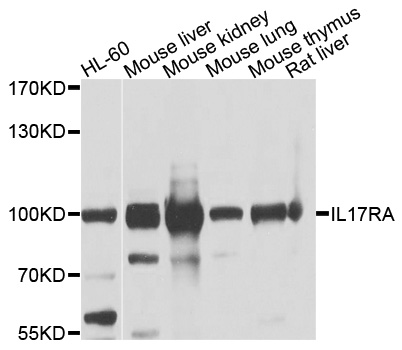 IL17RA Antibody - Western blot analysis of extracts of various cell lines, using IL17RA antibody at 1:1000 dilution. The secondary antibody used was an HRP Goat Anti-Rabbit IgG (H+L) at 1:10000 dilution. Lysates were loaded 25ug per lane and 3% nonfat dry milk in TBST was used for blocking. An ECL Kit was used for detection and the exposure time was 5s.