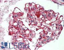 IL17RB Antibody - Human Kidney: Formalin-Fixed, Paraffin-Embedded (FFPE), at a concentration of 10 ug/ml. 