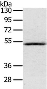 IL17RB Antibody - Western blot analysis of Human normal liver tissue, using IL17RB Polyclonal Antibody at dilution of 1:200.