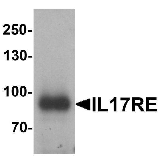 IL17RE Antibody - Western blot analysis of IL-17RE in human ovary tissue lysate with IL-17RE antibody at 1 ug/ml.