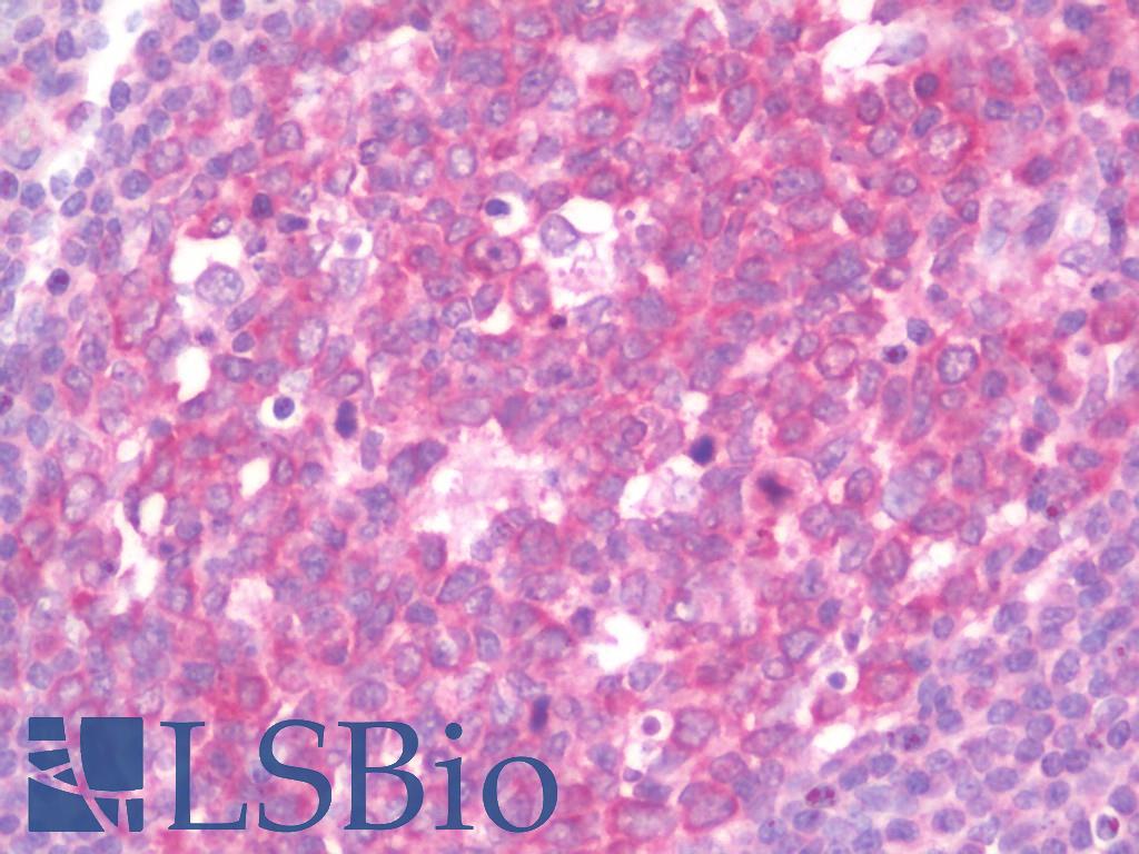 IL17RE Antibody - Anti-IL17RE antibody IHC staining of human tonsil. Immunohistochemistry of formalin-fixed, paraffin-embedded tissue after heat-induced antigen retrieval. Antibody concentration 10 ug/ml.
