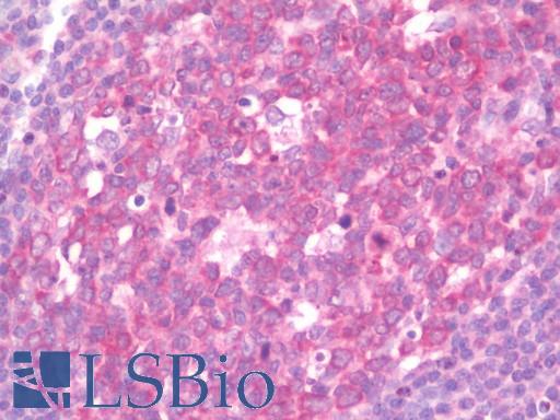IL17RE Antibody - Anti-IL17RE antibody IHC staining of human tonsil. Immunohistochemistry of formalin-fixed, paraffin-embedded tissue after heat-induced antigen retrieval. Antibody concentration 10 ug/ml.