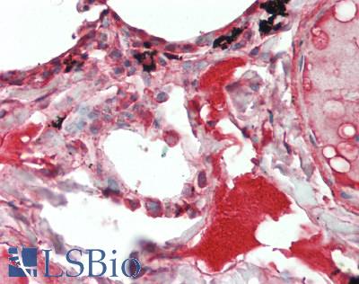 IL19 Antibody - Human Lung: Formalin-Fixed, Paraffin-Embedded (FFPE), at a concentration of 10 ug/ml. 