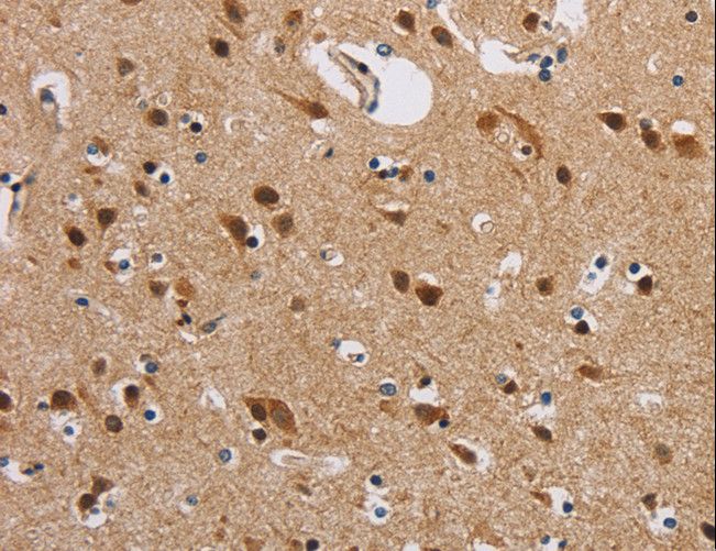 IL19 Antibody - Immunohistochemistry of paraffin-embedded Human brain using IL19 Polyclonal Antibody at dilution of 1:40.