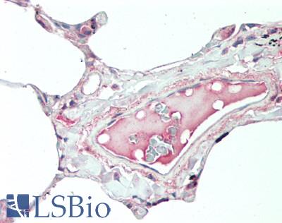 IL19 Antibody - Human Lung: Formalin-Fixed, Paraffin-Embedded (FFPE), at a concentration of 10 ug/ml. 