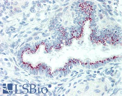 IL19 Antibody - Human Uterus: Formalin-Fixed, Paraffin-Embedded (FFPE), at a concentration of 10 ug/ml.