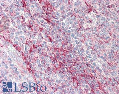 IL1F9 Antibody - Human Tonsil: Formalin-Fixed, Paraffin-Embedded (FFPE), at a concentration of 10 ug/ml. 