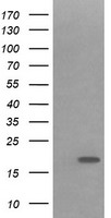 IL1F9 Antibody - HEK293T cells were transfected with the pCMV6-ENTRY control (Left lane) or pCMV6-ENTRY IL1F9 (Right lane) cDNA for 48 hrs and lysed. Equivalent amounts of cell lysates (5 ug per lane) were separated by SDS-PAGE and immunoblotted with anti-IL1F9.