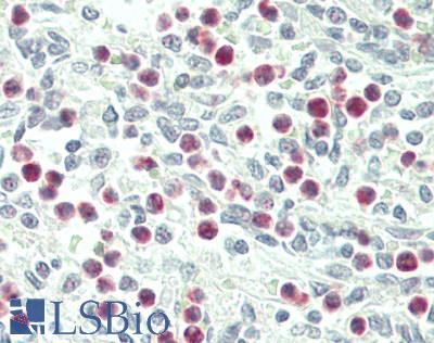 IL1F9 Antibody - Human Spleen, Neutrophils: Formalin-Fixed, Paraffin-Embedded (FFPE)