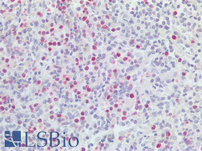 IL1F9 Antibody - Human Spleen: Formalin-Fixed, Paraffin-Embedded (FFPE)