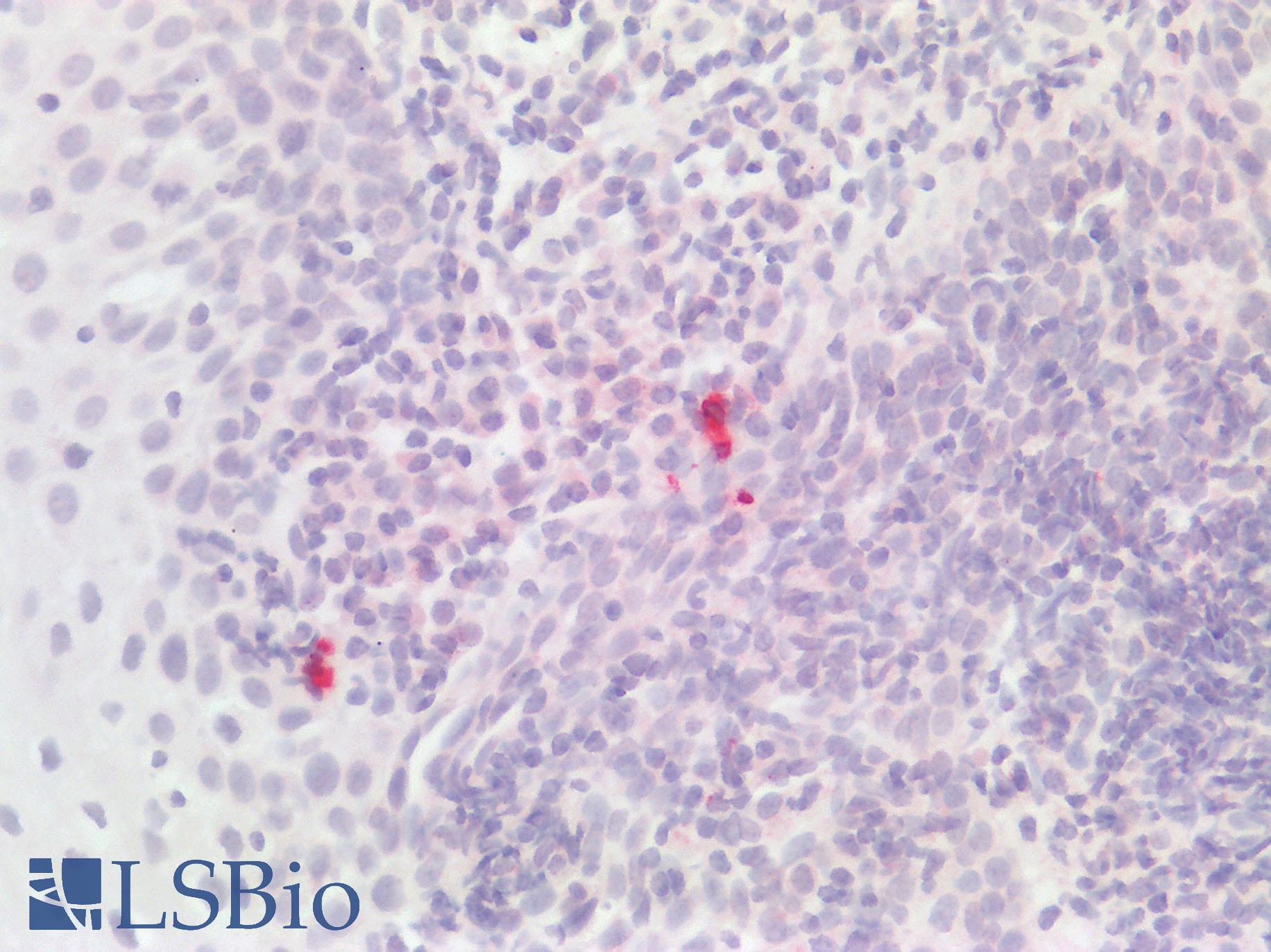 IL1F9 Antibody - Human Tonsil: Formalin-Fixed, Paraffin-Embedded (FFPE)