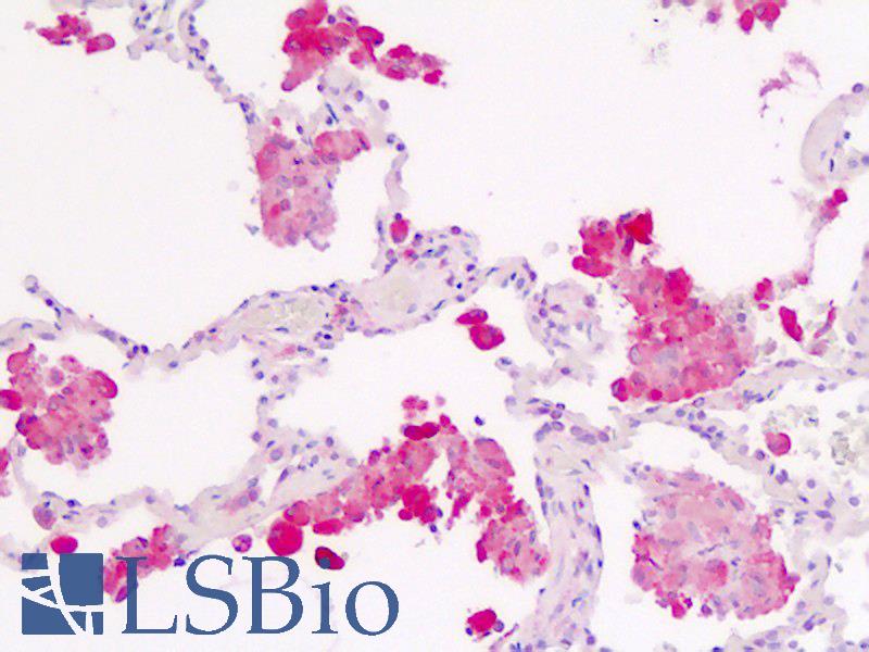 IL1R1 Antibody - Anti-IL1R1 antibody IHC staining of human lung, macrophages. Immunohistochemistry of formalin-fixed, paraffin-embedded tissue after heat-induced antigen retrieval.