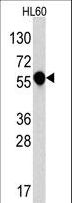 IL1R1 Antibody - Western blot of anti-IL1R in HL60 cell line lysates (35 ug/lane). IL1R (arrow) was detected using the purified antibody.