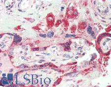 IL1RL1 Antibody - Human Placenta: Formalin-Fixed, Paraffin-Embedded (FFPE)
