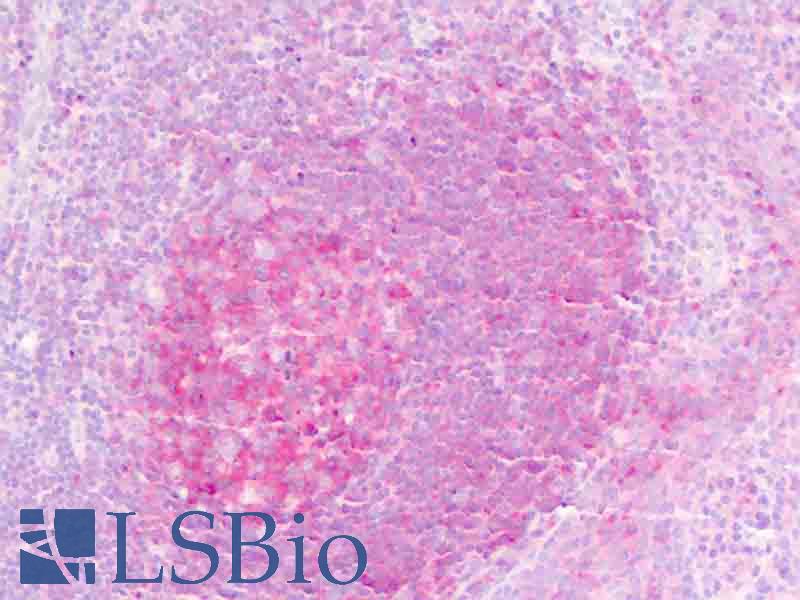 IL1RL2 Antibody - Anti-IL1RL2 antibody IHC staining of human tonsil, germinal center. Immunohistochemistry of formalin-fixed, paraffin-embedded tissue after heat-induced antigen retrieval.