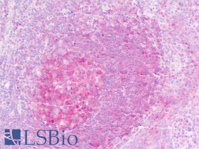 IL1RL2 Antibody - Anti-IL1RL2 antibody IHC staining of human tonsil, germinal center. Immunohistochemistry of formalin-fixed, paraffin-embedded tissue after heat-induced antigen retrieval.