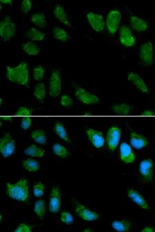 IL1RN Antibody - Immunofluorescence analysis of MCF7 cell using IL1RN antibody. Blue: DAPI for nuclear staining.