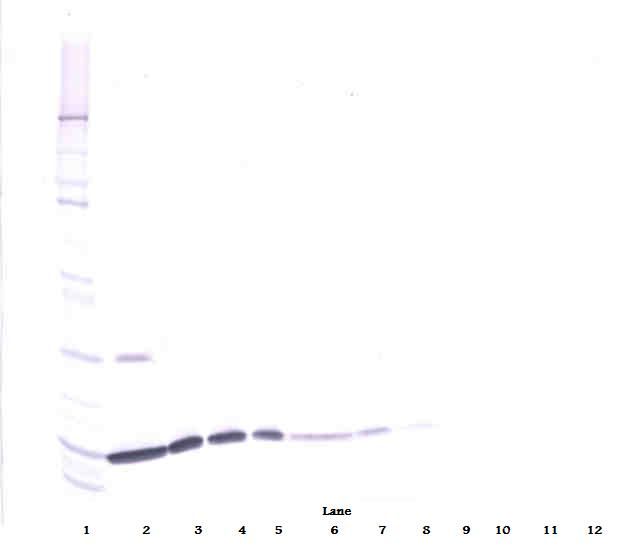 IL2 Antibody - Western Blot (reducing) of IL-2 antibody