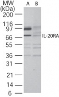IL20RA Antibody - Western blot of IL-20RA in A375 cell lysate in the (A)?absence and (B) presence of blocking peptide using antibody at 2 ug/ml.