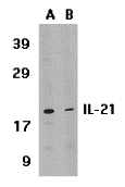 IL21 Antibody - Western blot analysis of IL-21 expression in HL-60 cell lysate in (A) the absence or (B) the presence of blocking peptide with IL-21 antibody at 1 ug /ml.