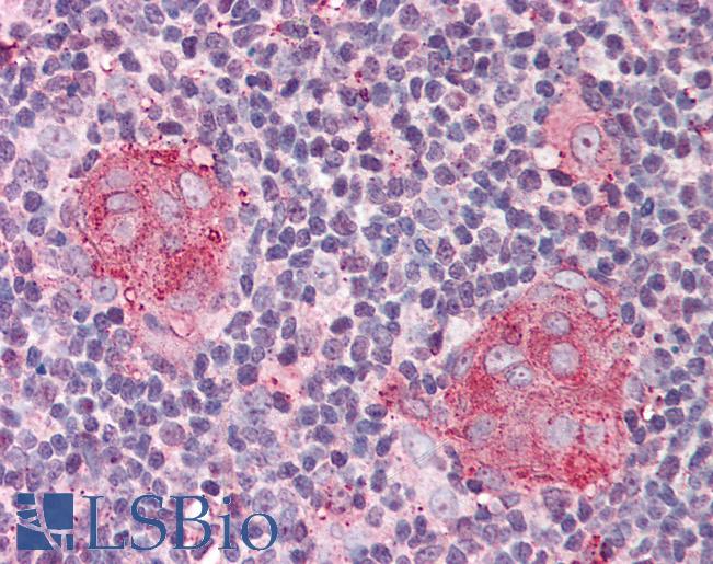 IL21 Receptor Antibody - Anti-IL21 Receptor antibody IHC of human thymus. Immunohistochemistry of formalin-fixed, paraffin-embedded tissue after heat-induced antigen retrieval. Antibody concentration 5 ug/ml.