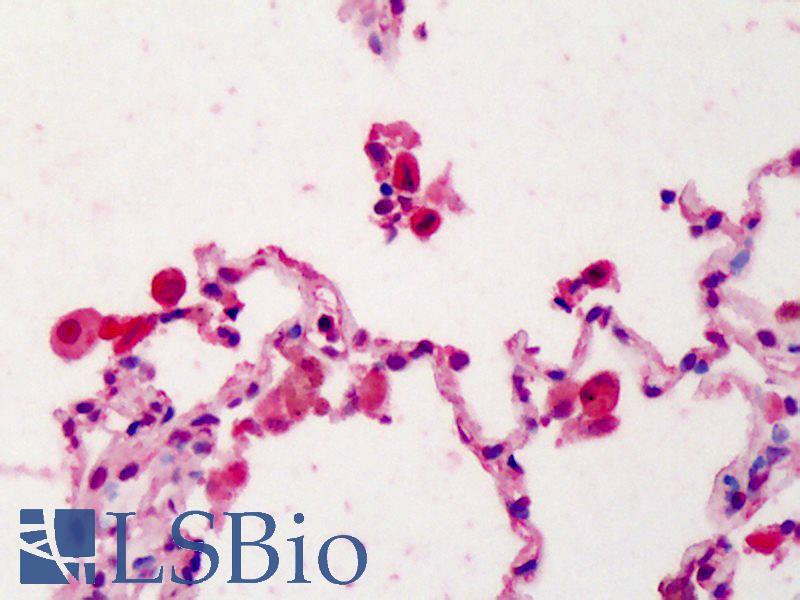 IL22RA1 / IL22R Antibody - Anti-IL22RA1 / IL22R antibody IHC of human lung. Immunohistochemistry of formalin-fixed, paraffin-embedded tissue after heat-induced antigen retrieval. Antibody concentration 5 ug/ml.
