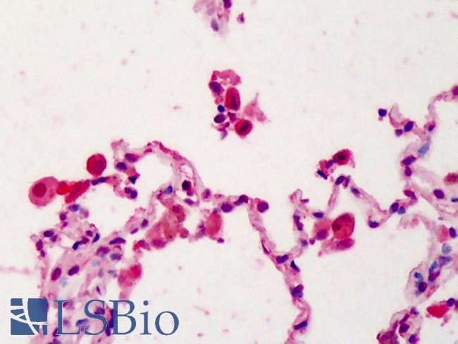 IL22RA1 / IL22R Antibody - Anti-IL22RA1 / IL22R antibody IHC of human lung. Immunohistochemistry of formalin-fixed, paraffin-embedded tissue after heat-induced antigen retrieval. Antibody concentration 5 ug/ml.