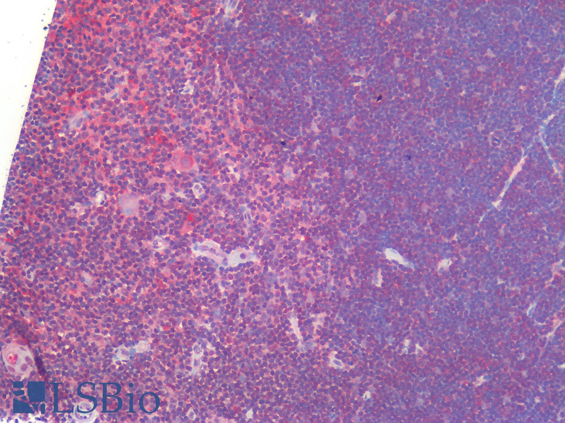 IL23A / IL-23 p19 Antibody - Human Thymus: Formalin-Fixed, Paraffin-Embedded (FFPE)