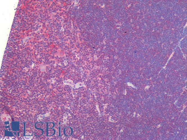 IL23A / IL-23 p19 Antibody - Human Thymus: Formalin-Fixed, Paraffin-Embedded (FFPE)
